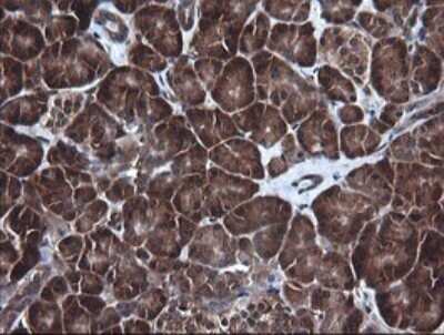 Immunohistochemistry: RIG-I Antibody (OTI6C1) [NBP2-45678] - Analysis of Human pancreas tissue. (Heat-induced epitope retrieval by 10mM citric buffer, pH6.0, 120C for 3min)