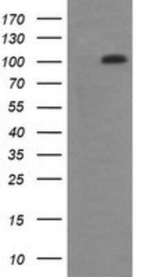 Western Blot: RIG-I Antibody (OTI6C1) [NBP2-45678] - Analysis of HEK293T cells were transfected with the pCMV6-ENTRY control (Left lane) or pCMV6-ENTRY RIG-I.