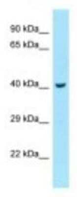 Western Blot: RILP Antibody [NBP1-98279] - NCI-H226 Cell Lysate 1.0ug/ml, Gel Concentration: 12%