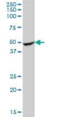 Western Blot RILPL1 Antibody - Azide and BSA Free