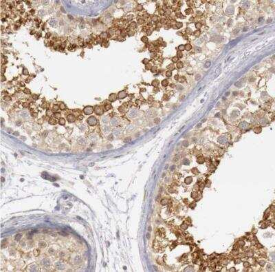 Immunohistochemistry-Paraffin: RIMBP3 Antibody [NBP1-81387] - Staining of human testis shows strong cytoplasmic positivity in seminiferous ducts.