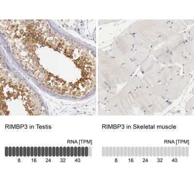 Immunohistochemistry-Paraffin: RIMBP3 Antibody [NBP1-81387] - Analysis in human testis and skeletal muscle tissues using NBP1-81387 antibody. Corresponding RIMBP3 RNA-seq data are presented for the same tissues.