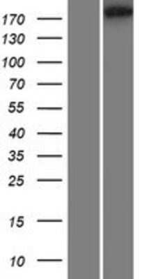 Western Blot: RIMBP3 Overexpression Lysate (Adult Normal) [NBP2-07131] Left-Empty vector transfected control cell lysate (HEK293 cell lysate); Right -Over-expression Lysate for RIMBP3.