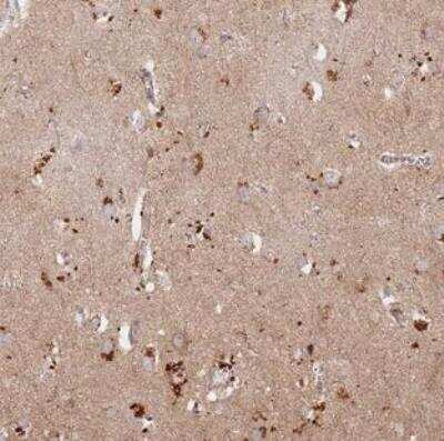 Immunohistochemistry-Paraffin: RIMS Binding Protein 2 Antibody [NBP2-30643] - Staining of human cerebral cortex shows strong cytoplasmic positivity in neuronal cells.