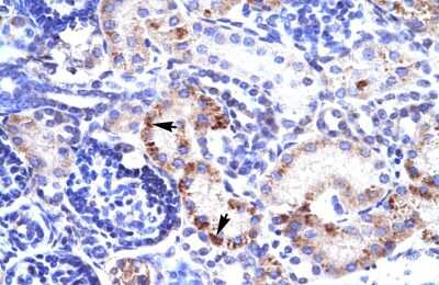 Immunohistochemistry: RIMS3 Antibody [NBP2-85639] - Human kidney