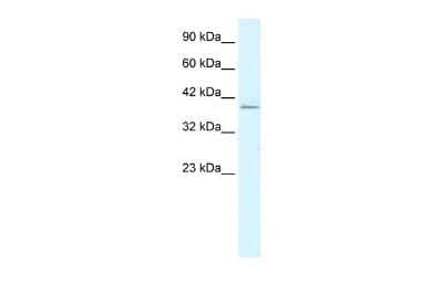 Western Blot: RIMS3 Antibody [NBP2-85639] - WB Suggested Anti-RIMS3 Antibody Titration: 1.25ug/ml. ELISA Titer: 1:312500. Positive Control: Jurkat cell lysateRIMS3 is strongly supported by BioGPS gene expression data to be expressed in Human Jurkat cells
