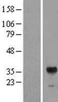 Western Blot: RIMS3 Overexpression Lysate (Adult Normal) [NBL1-15371] Left-Empty vector transfected control cell lysate (HEK293 cell lysate); Right -Over-expression Lysate for RIMS3.
