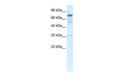 Western Blot: RIN3 Antibody [NBP2-83448] - WB Suggested Anti-RIN3 Antibody Titration: 5.0ug/ml. ELISA Titer: 1:62500. Positive Control: HepG2 cell lysateThere is BioGPS gene expression data showing that RIN3 is expressed in HepG2