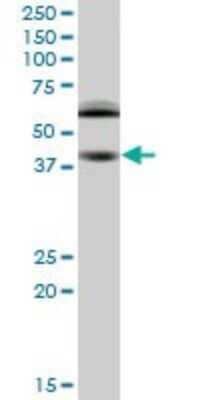 Western Blot: RING1 Antibody (2B3) [H00006015-M03] - Analysis of RING1 expression in RIN-m5F.