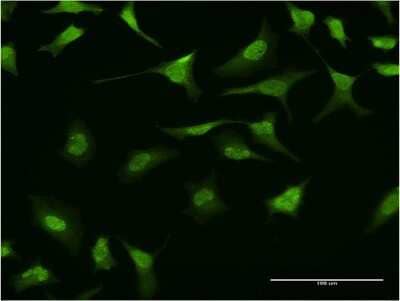 Immunocytochemistry/Immunofluorescence: RING1 Antibody (2D5) [H00006015-M12] - Analysis of monoclonal antibody to RING1 on HeLa cell. Antibody concentration 10 ug/ml