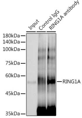 Immunoprecipitation: RING1 Antibody (2Q8D5) [NBP3-15893] - Immunoprecipitation analysis of 300ug extracts of HeLa cells using 3ug RING1 antibody (NBP3-15893). Western blot was performed from the immunoprecipitate using RING1 antibody (NBP3-15893) at a dilition of 1:1000.