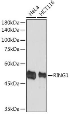 Western Blot: RING1 Antibody (2Q8D5) [NBP3-15893] - Western blot analysis of extracts of various cell lines, using RING1 Rabbit mAb (NBP3-15893) at 1:1000 dilution. Secondary antibody: HRP Goat Anti-Rabbit IgG (H+L) at 1:10000 dilution. Lysates/proteins: 25ug per lane. Blocking buffer: 3% nonfat dry milk in TBST. Detection: ECL Basic Kit. Exposure time: 90s.