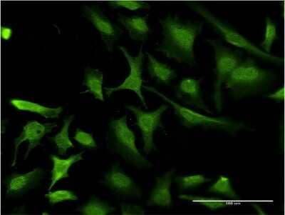 Immunocytochemistry/Immunofluorescence: RING1 Antibody (4E8) [H00006015-M07] - Analysis of monoclonal antibody to RING1 on HeLa cell. Antibody concentration 10 ug/ml