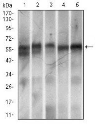 Western Blot: RING1 Antibody (8C12F4) [NBP2-37370] - Analysis using Ring1 mouse mAb against MOLT-4 (1), LNCaP (2), Hela (3), HEK-293 (4) and Jurkat (5) cell lysate.