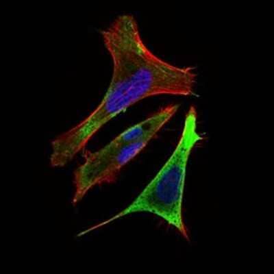 Immunocytochemistry/Immunofluorescence: RING1 Antibody (8E8A2) [NBP2-37319] - Immunofluorescence analysis of Hela cells using Ring1 mouse mAb (green). Blue: DRAQ5 fluorescent DNA dye. Red: Actin filaments have been labeled with Alexa Fluor-555 phalloidin.