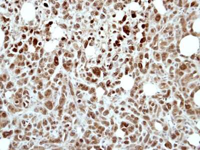 Immunohistochemistry-Paraffin: RING1 Antibody [NBP2-20164] - Immunohistochemical analysis of paraffin-embedded PC9 xenograft, using antibody at 1:500 dilution.