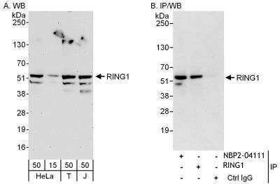 Immunoprecipitation: RING1 Antibody [NBP2-04111] - Samples: Whole cell lysate from HeLa (15 and 50 ug for WB; 1 mg for IP, 20% of IP loaded), 293T (T; 50 ug) and Jurkat (J; 50 ug) cells. Antibodies: Affinity purified rabbit anti-RING1 antibody NBP2-04111used for WB at 0.1 ug/ml (A) and 1 ug/ml (B) and used for IP at 6 ug/mg lysate. RING1 was also immunoprecipitated by rabbit anti-RING1 antibody, which recognizes a downstream epitope. Detection: Chemiluminescence with exposure times of 3 minutes (A) and 10 seconds (B).