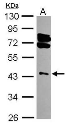 Western Blot: RING1 Antibody [NBP2-20164] - Sample (30 ug of whole cell lysate) A: 293T 10% SDS PAGE gel, diluted at 1:3000.