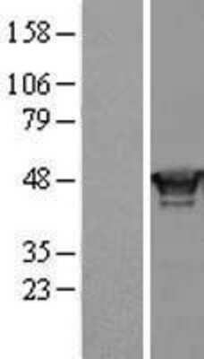 Western Blot: RING1 Overexpression Lysate (Adult Normal) [NBL1-15372] Left-Empty vector transfected control cell lysate (HEK293 cell lysate); Right -Over-expression Lysate for RING1.