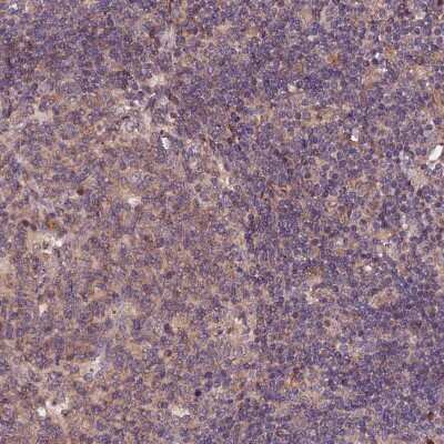 Immunohistochemistry-Paraffin: RINL Antibody [NBP1-93741] - Staining of human lymph node shows cytoplasmic positivity in germinal center cells and non-germinal center cells.