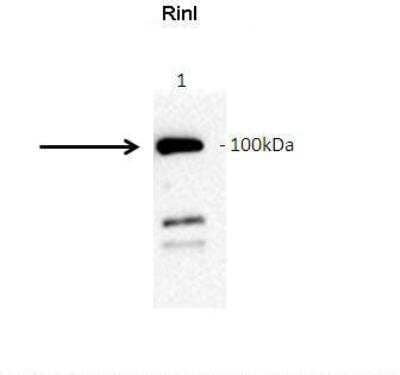 Immunoprecipitation: RINL Antibody [NBP2-85640] - Amount and Sample Type: GFP-hRinl transfected COS7 cell lysate. Amount of IP Antibody: 10ug. Primary Antibody: anti-GFP. Primary Antibody Dilution: 1:1000. Secondary Antibody: Goat anti-rabbit-HRP. Secondary Antibody Dilution: 1:5000. Gene Name: RINL. Submitted by: Barbara Woller; Medical University of Vienna
