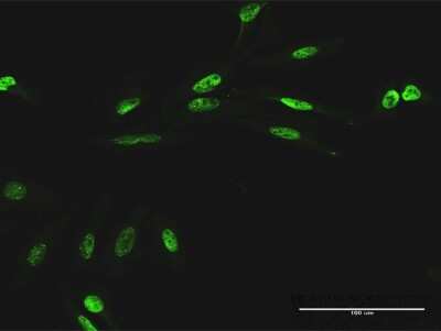 Immunocytochemistry/Immunofluorescence: RIOK1 Antibody [H00083732-B02P] - Analysis of purified antibody to RIOK1 on HeLa cell. (antibody concentration 20 ug/ml)