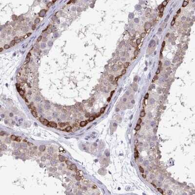 Immunohistochemistry-Paraffin: RIOK1 Antibody [NBP2-47300] - Staining of human testis shows high expression.