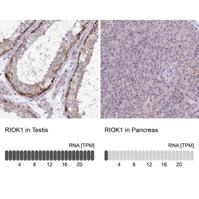 Immunohistochemistry-Paraffin: RIOK1 Antibody [NBP2-47300] - Analysis in human testis and pancreas tissues using NBP2-47300 antibody. Corresponding RIOK1 RNA-seq data are presented for the same tissues.