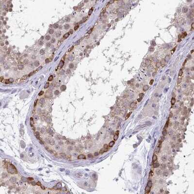 Immunohistochemistry-Paraffin: RIOK1 Antibody [NBP2-47301] - Staining of human testis shows moderate cytoplasmic positivity in subset of cells in seminiferous ducts.