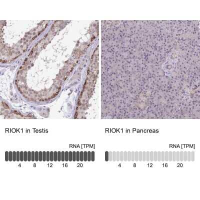 Immunohistochemistry-Paraffin RIOK1 Antibody - BSA Free