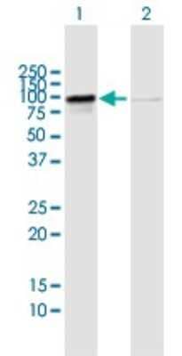 Western Blot: RIOK1 Antibody [H00083732-B02P] - Analysis of RIOK1 expression in transfected 293T cell line by RIOK1 polyclonal antibody.  Lane 1: RIOK1 transfected lysate(65.6 KDa). Lane 2: Non-transfected lysate.