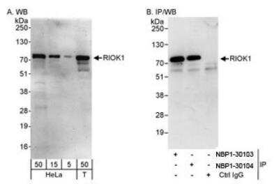 Western Blot RIOK1 Antibody