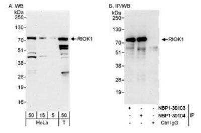 Western Blot RIOK1 Antibody