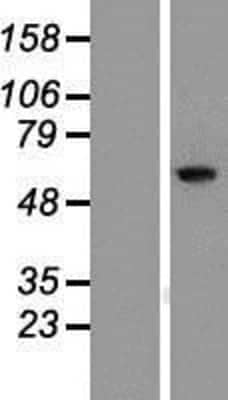 Western Blot: RIOK1 Overexpression Lysate (Adult Normal) [NBP2-09925] Left-Empty vector transfected control cell lysate (HEK293 cell lysate); Right -Over-expression Lysate for RIOK1.