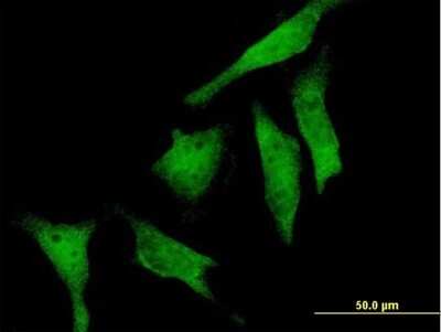 Immunocytochemistry/Immunofluorescence: RIOK2 Antibody [H00055781-B01P] - Analysis of purified antibody to RIOK2 on HeLa cell. (antibody concentration 10 ug/ml)