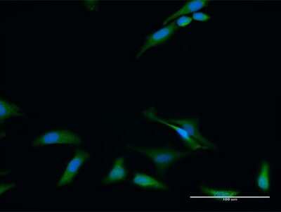 Immunocytochemistry/Immunofluorescence: RIOK2 Antibody [H00055781-D01P] - Analysis of antibody to RIOK2 on HeLa cell. Antibody concentration 30 ug/ml.
