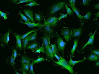 Immunocytochemistry/Immunofluorescence: RIOK2 Antibody [NBP2-97641] - Immunofluorescence staining of RIOK2 in U251MG cells. Cells were fixed with 4% PFA, permeabilzed with 0.1% Triton X-100 in PBS, blocked with 10% serum, and incubated with rabbit anti-Human RIOK2 polyclonal antibody (dilution ratio 1:200) at 4C overnight. Then cells were stained with the Alexa Fluor(R)488-conjugated Goat Anti-rabbit IgG secondary antibody (green) and counterstained with DAPI (blue).Positive staining was localized to Cytoplasm.