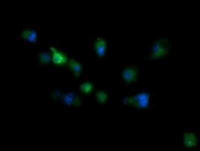 Immunocytochemistry/Immunofluorescence: RIOK2 Antibody (OTI3E11) - Azide and BSA Free [NBP2-73910] - Analysis of COS7 cells transiently transfected by pCMV6-ENTRY RIOK2.