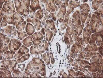 Immunohistochemistry: RIOK2 Antibody (OTI3E11) - Azide and BSA Free [NBP2-73910] - Analysis of Human pancreas tissue.