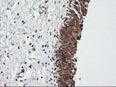 Immunohistochemistry: RIOK2 Antibody (OTI3E11) [NBP2-45960] - Analysis of Human bladder tissue.
