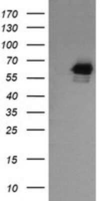 Western Blot: RIOK2 Antibody (OTI3E11) [NBP2-45960] - Analysis of HEK293T cells were transfected with the pCMV6-ENTRY control (Left lane) or pCMV6-ENTRY RIOK2.