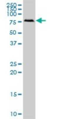 Western Blot: RIOK2 Antibody [H00055781-B01P] - Analysis of RIOK2 expression in COLO 320 HSR.
