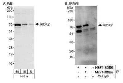 Western Blot: RIOK2 Antibody [NBP1-30098] - Whole cell lysate (5, 15 and 50 ug for WB; 1 mg for IP, 20% of IP loaded) from HeLa cells. NBP1-30098 was used for WB at 0.4 ug/ml (A) and 1 ug/ml (B) and used for IP at 3 ug/mg lysate.  RIOK2 was also immunoprecipitated by rabbit anti-RIOK2 antibody NBP1-30099, which recognizes a downstream epitope.