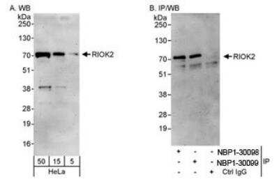 Western Blot: RIOK2 Antibody [NBP1-30099] - Whole cell lysate from HeLa cells. RIOK2 was also immunoprecipitated by rabbit anti-RIOK2 antibody NBP1-30098. For blotting IPed RIOK2, the ReliaBLOT  Reagents and Procedures WB120 were used.