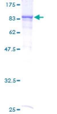SDS-PAGE Recombinant Human RIOK2 GST (N-Term) Protein