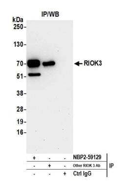 RIOK3 Antibody [NBP2-59129] - Detection of human RIOK3 by western blot of immunoprecipitates. Samples: Whole cell lysate (0.5 or 1.0 mg per IP reaction; 20% of IP loaded) from 293T cells prepared using NETN lysis buffer. Antibodies: Affinity purified rabbit anti-RIOK3 antibody NBP2-59129 used for IP at 20 ul per reaction. RIOK3 was also immunoprecipitated by another rabbit anti-RIOK3 antibody. For blotting immunoprecipitated RIOK3, NBP2-59129 was used at 1:250. Detection: Chemiluminescence with an exposure time of 30 seconds.