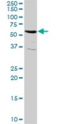 Western Blot: RIOK3 Antibody [H00008780-D01P] - Analysis of RIOK3 expression in mouse kidney.