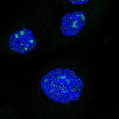 Immunocytochemistry/Immunofluorescence: RIP140 Antibody [NBP2-57193] - Staining of human cell line A-431 shows localization to nucleus & nucleoli.