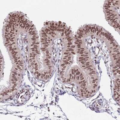 Immunohistochemistry-Paraffin: RIP140 Antibody [NBP2-13674] - Staining of human Fallopian tube shows moderate nuclear positivity in glandular cells.