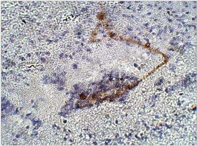 Immunohistochemistry-Paraffin RIP140 Antibody